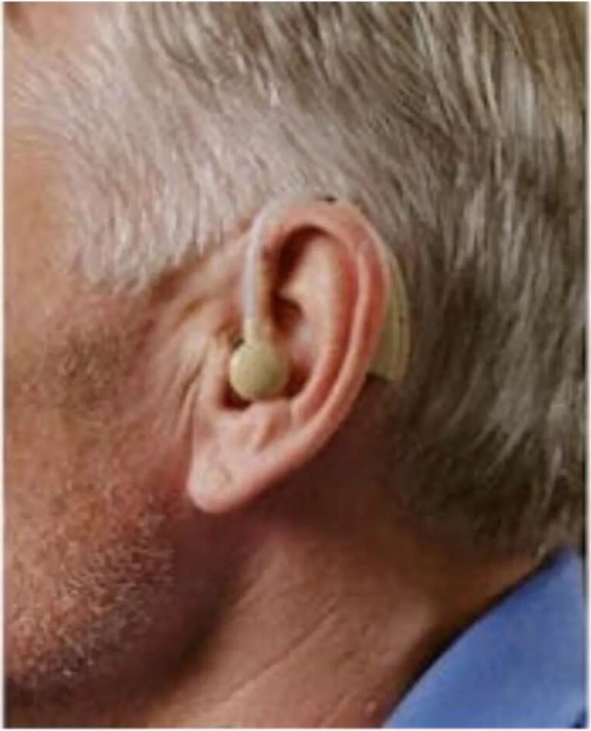 HD Smart Ear Amplification Device